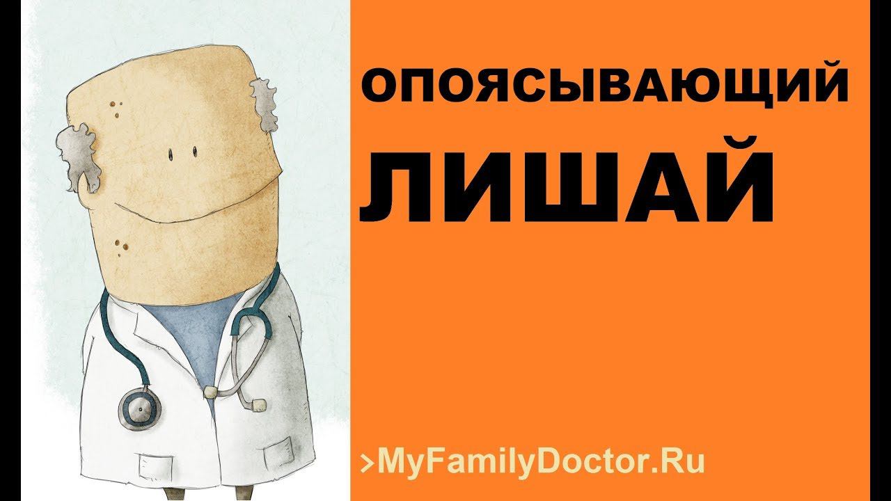 Как лечить опоясывающий лишай смотреть онлайн