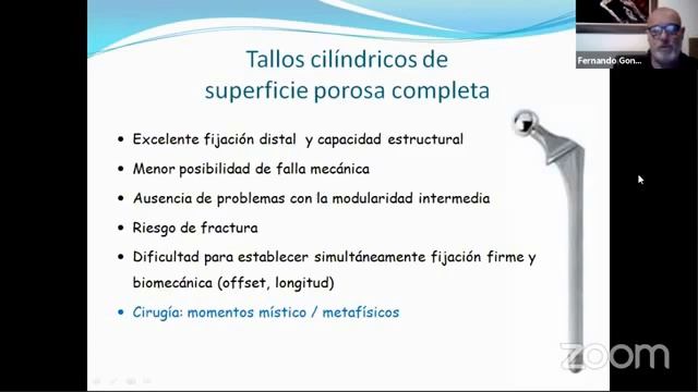 10- Revisión del Tallo Femoral смотреть онлайн