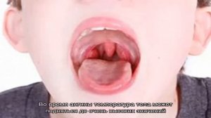 Причины покраснения в горле у ребенка и взрослого
