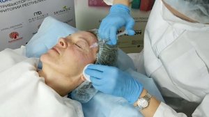 Устранение малярных мешков препаратом Hyalrepair® - 08 Bioreparant