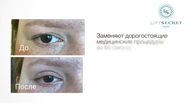 Лифтинг-полоски Eye Lift Secret для мгновенной коррекции век смотреть онлайн