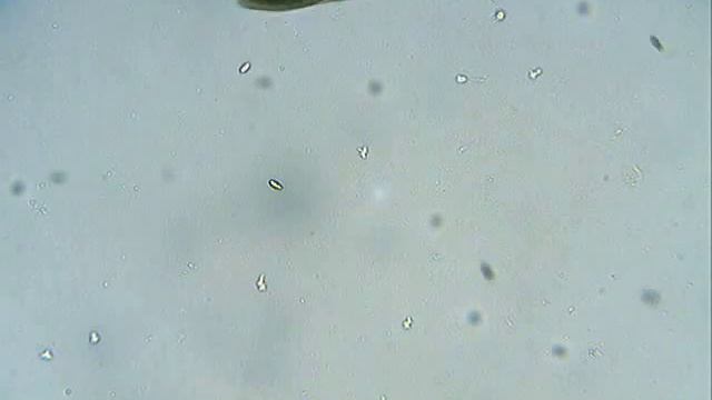 Коньгация у инфузории туфельки смотреть онлайн