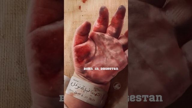 Звонок в сеть Палония Махачкала. #palestine #палестина #gaza