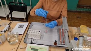 Лабораторная работа «Скорость оседания эритроцитов»