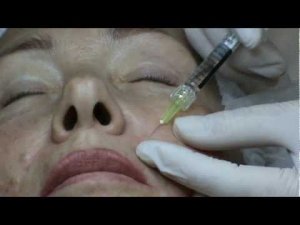 Princess Rich, биоревитализация лица, обучение, 111128