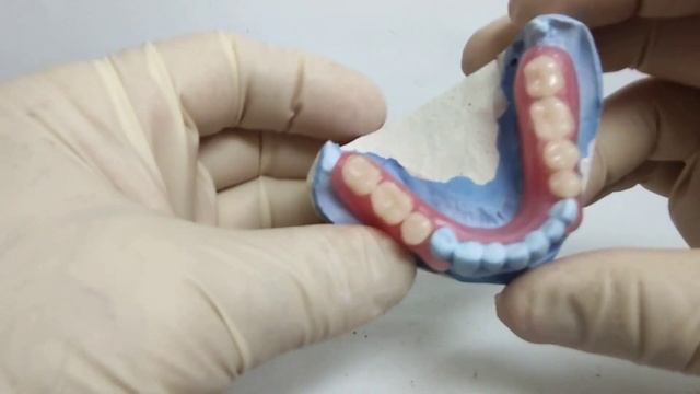 Частично съёмный протез! смотреть онлайн