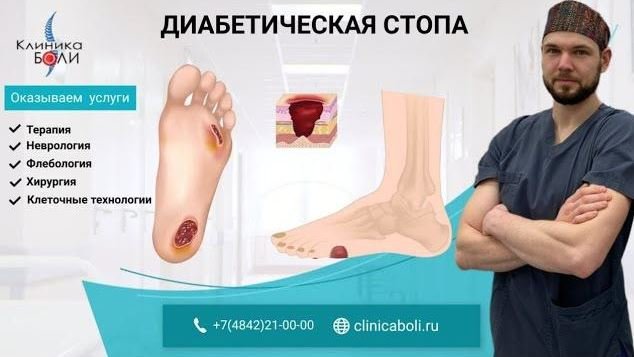 БОЛЯТ и БЛЕДНЕЮТ ПАЛЬЦЫ РУК НА ХОЛОДЕ. Синдром Рейно смотреть онлайн