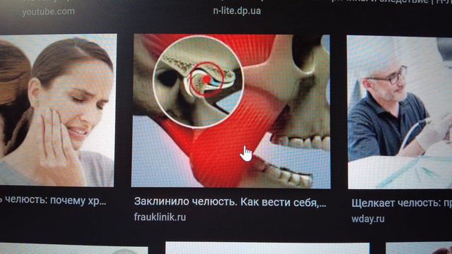 Челюсть щолкає смотреть онлайн