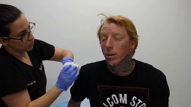 Justin's Inspiring Transformation - Face Tattoo Removal - 11th Treatment смотреть онлайн