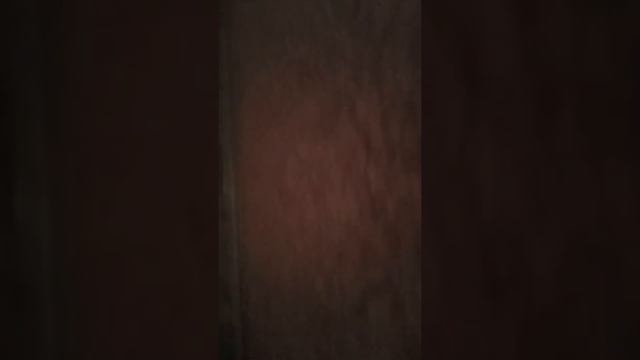 Москвич подавился Салом насмерть скорая помощь не успела его спасти смотреть онлайн