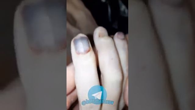 После осмотра тела Тсака, на нем были обнаружены следы пыток смотреть онлайн