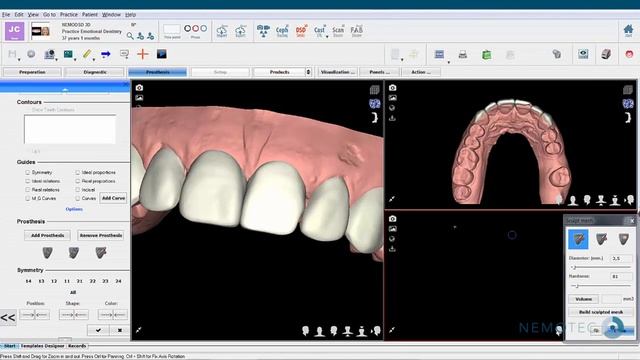 Video DEMO NEMODSD 3D Digital Smile Design Long Version смотреть онлайн