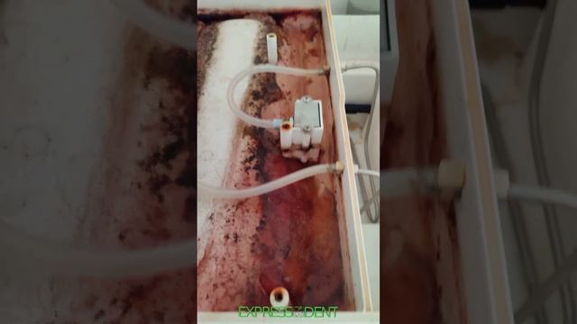 Професійне чищення автоклаву класу В від бактерій та засмічення парогенератора, сервіс Expressdent смотреть онлайн