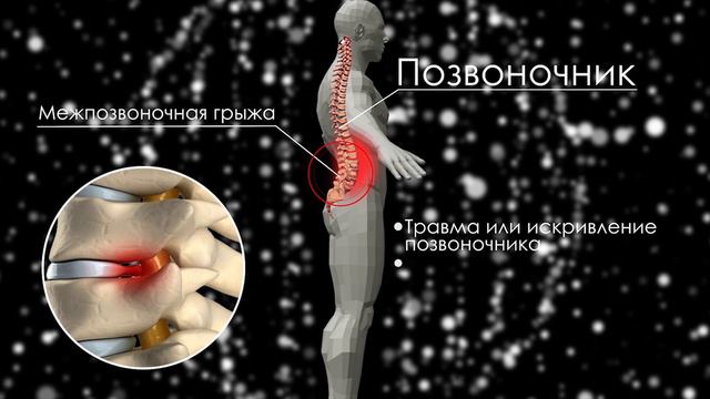 MPT.Спина. смотреть онлайн