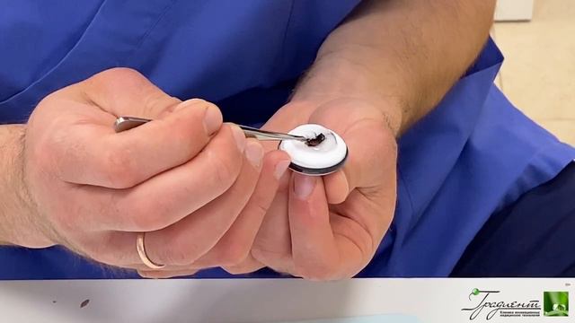 Удаление базалиомы по методу MOHS
Гришко Роман Васильевич:
Руководитель направления дерматоонкологии смотреть онлайн