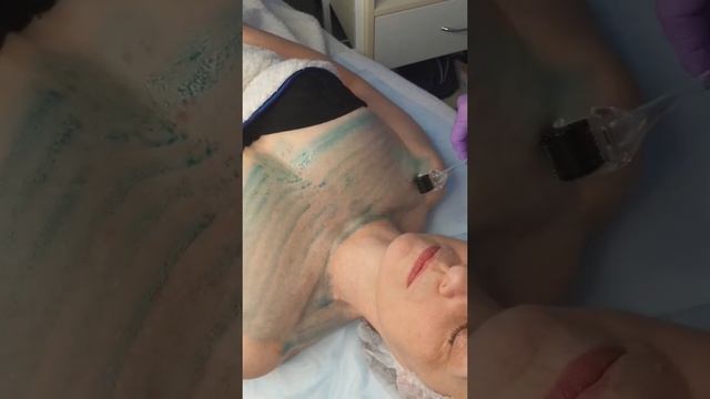 Омоложение зоны декольте. смотреть онлайн