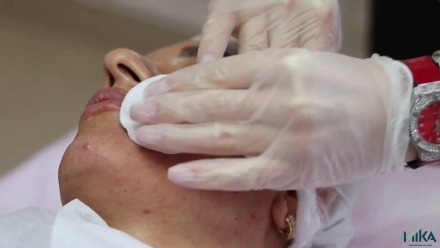 Что такое мезотерапия? Центр МИКА отвечает и показывает. смотреть онлайн