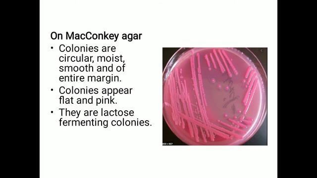 Culture characteristics of Escherichia coli - J Mary Pohsnem, Dept of MLT - AdtU смотреть онлайн