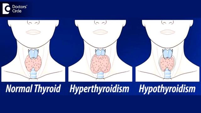 What does mild bleeding followed by negative pregnancy test signify? - Dr. Suhasini Inamdar смотреть онлайн