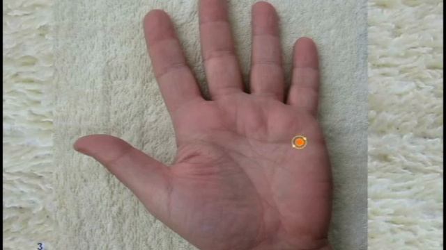 СуДжок. Антипаразитарная смотреть онлайн