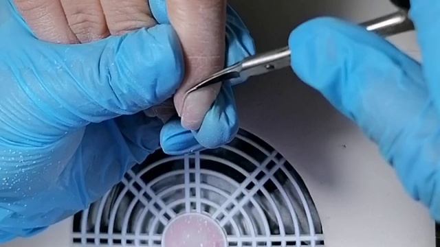 8 недель, травматический онихолизис смотреть онлайн