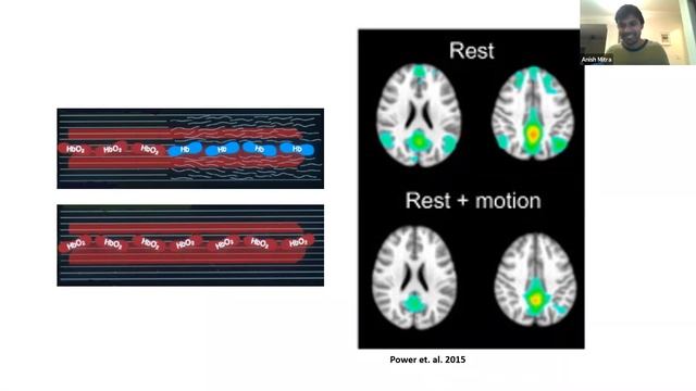 Demystifying the Default Mode Network смотреть онлайн