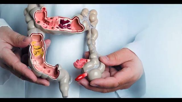 Как избавиться от запора? смотреть онлайн