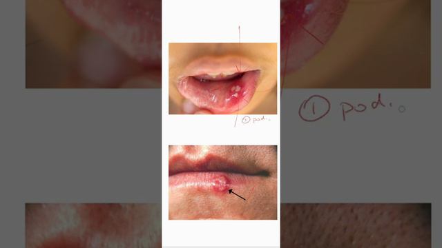 Drug Of Choice Series- Part 2.(Infectious Diseases+STDs) смотреть онлайн