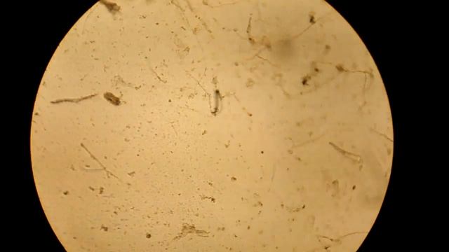 Nematode Trapping fungi parasitising Meloidogyne смотреть онлайн