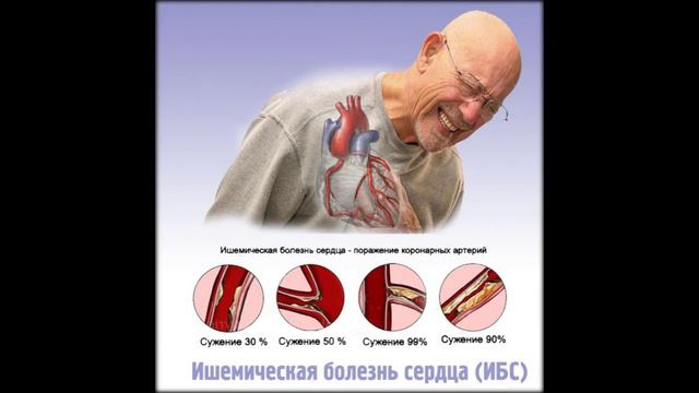болезни сердца 8 класс доклад смотреть онлайн