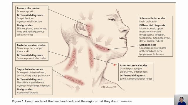 APPROACH TO PATIENT PRESENTING WITH ENLARGED LYMPH NODES смотреть онлайн