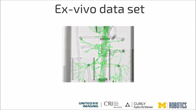 Iterative PnP and its application in 3D-2D vascular image registration for robot navigation смотреть онлайн