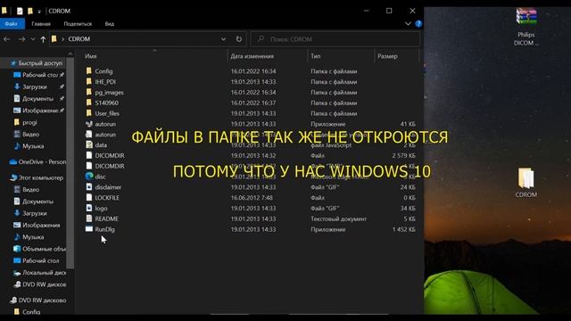 Как просмотреть диск МРТ или КТ программой Philips DICOM Viewer смотреть онлайн