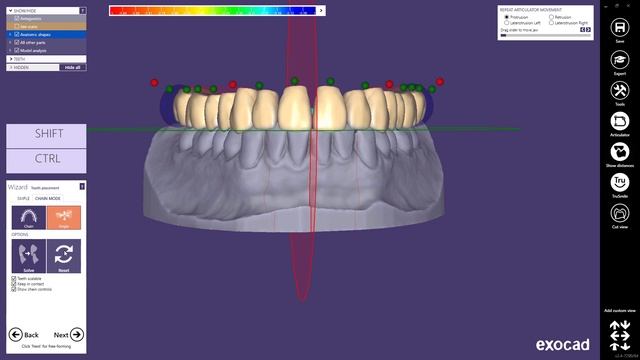 exocad Quick Guide: Designing a single arch denture смотреть онлайн