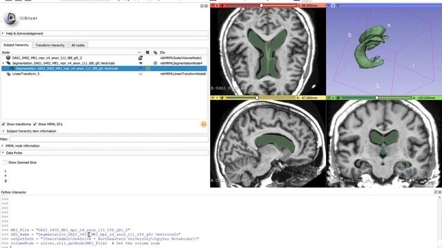 Converting Segment STL's to compressed Numpy arrays смотреть онлайн
