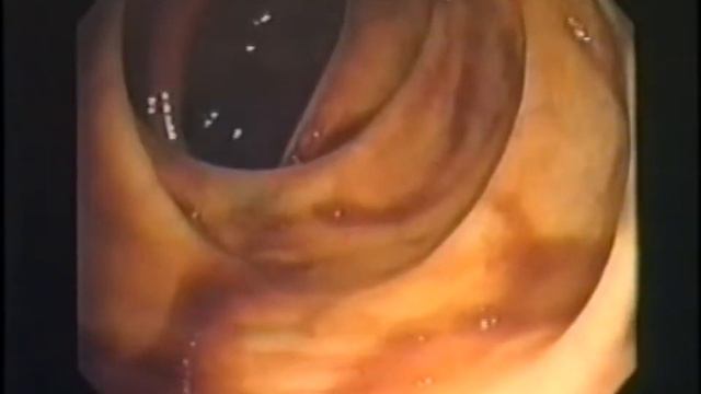 Воздействие молочнокислых бактерий на человека смотреть онлайн