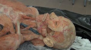 Анатомия. Мышцы головы и шеи