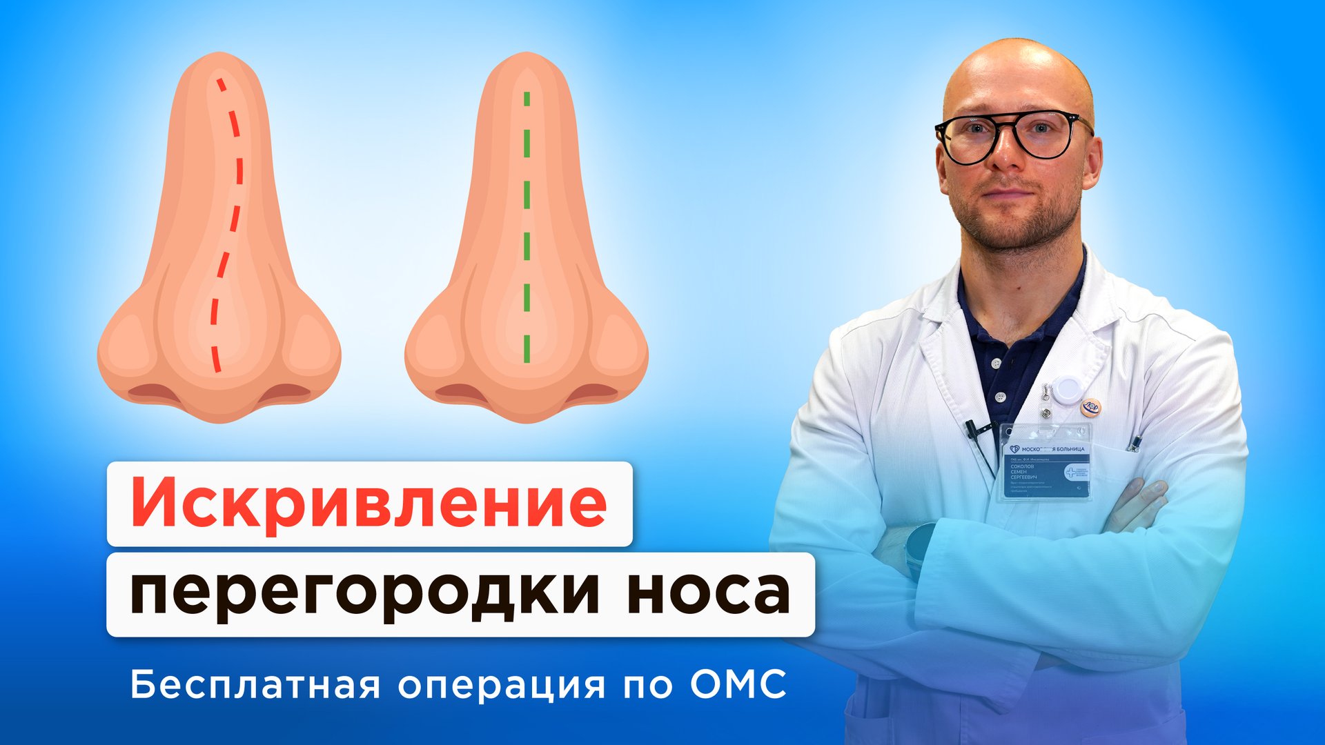 Искривление перегородки носа: когда нужна операция? смотреть онлайн