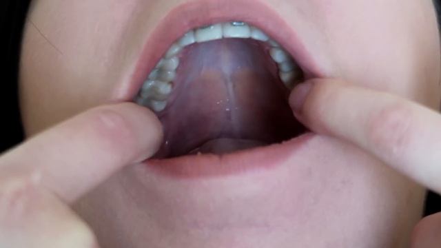 МИНУСЫ БРЕКЕТОВ! МОИ ЗУБЫ УМИРАЮТ. СТРАШНАЯ ИСТОРИЯ II OLYA GRACE смотреть онлайн