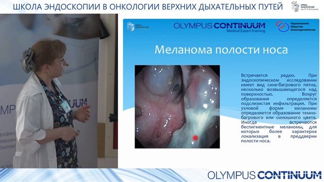 Школа эндоскопии в онкологии верхних дыхательных путей