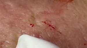 Enjoy Every Day With The Best Video Loan Nguyen Spa Official  2651