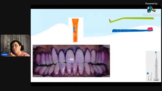 Профессиональная гигиена - Наталья Ефимова смотреть онлайн