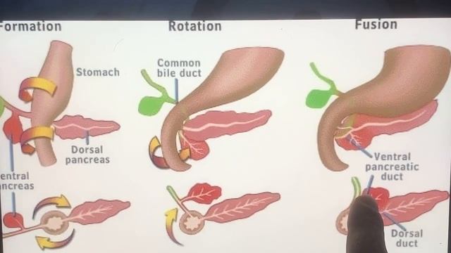 development of pancreas embryology | pancreas development embryology смотреть онлайн