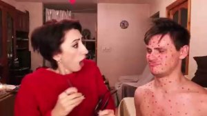 Мама и ветрянка