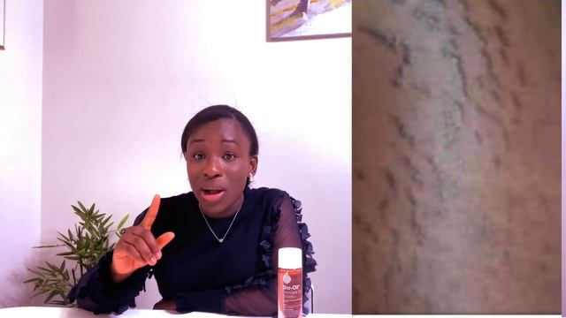 Unsponsored Bio oil review / Watch how my Stretch Marks improved using BIO OIL. смотреть онлайн
