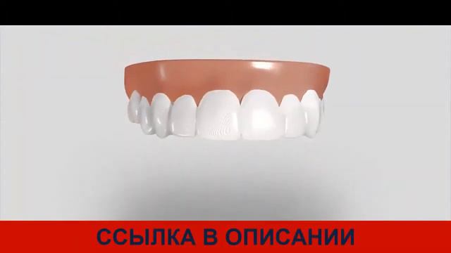 Snap On Smile съемные виниры смотреть онлайн