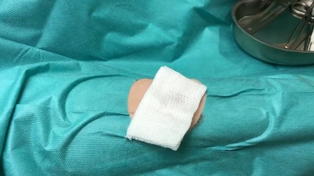 Удаление липомы на руке из маленького разреза смотреть онлайн