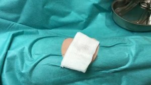 Удаление липомы на руке из маленького разреза