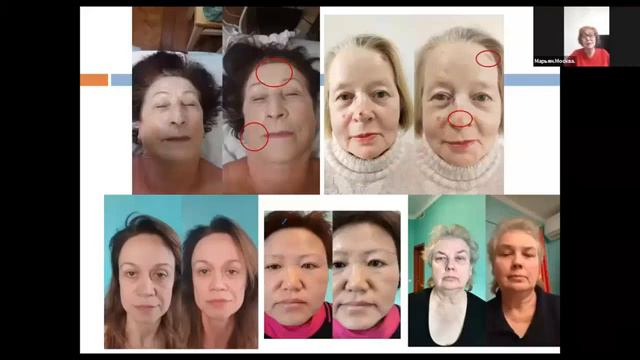WHIEDA Отзывы про активатор клеток смотреть онлайн