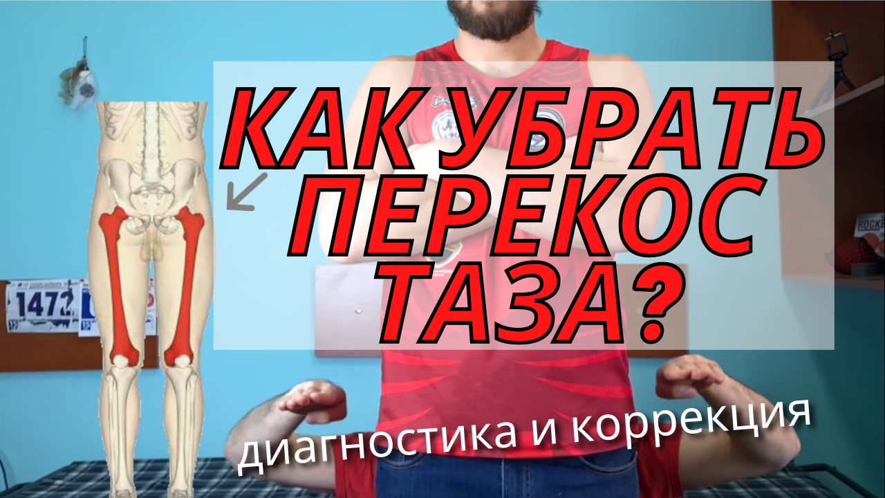 Перекос таза. Как выровнять таз через мышцы. Часть 1 смотреть онлайн